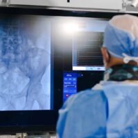 La ciencia da un paso adelante: Esprit BTK, innovación para quienes viven con Enfermedad Arterial Periférica